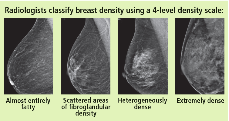 breast density