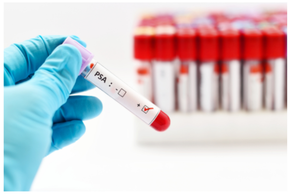 psa-test-positive
